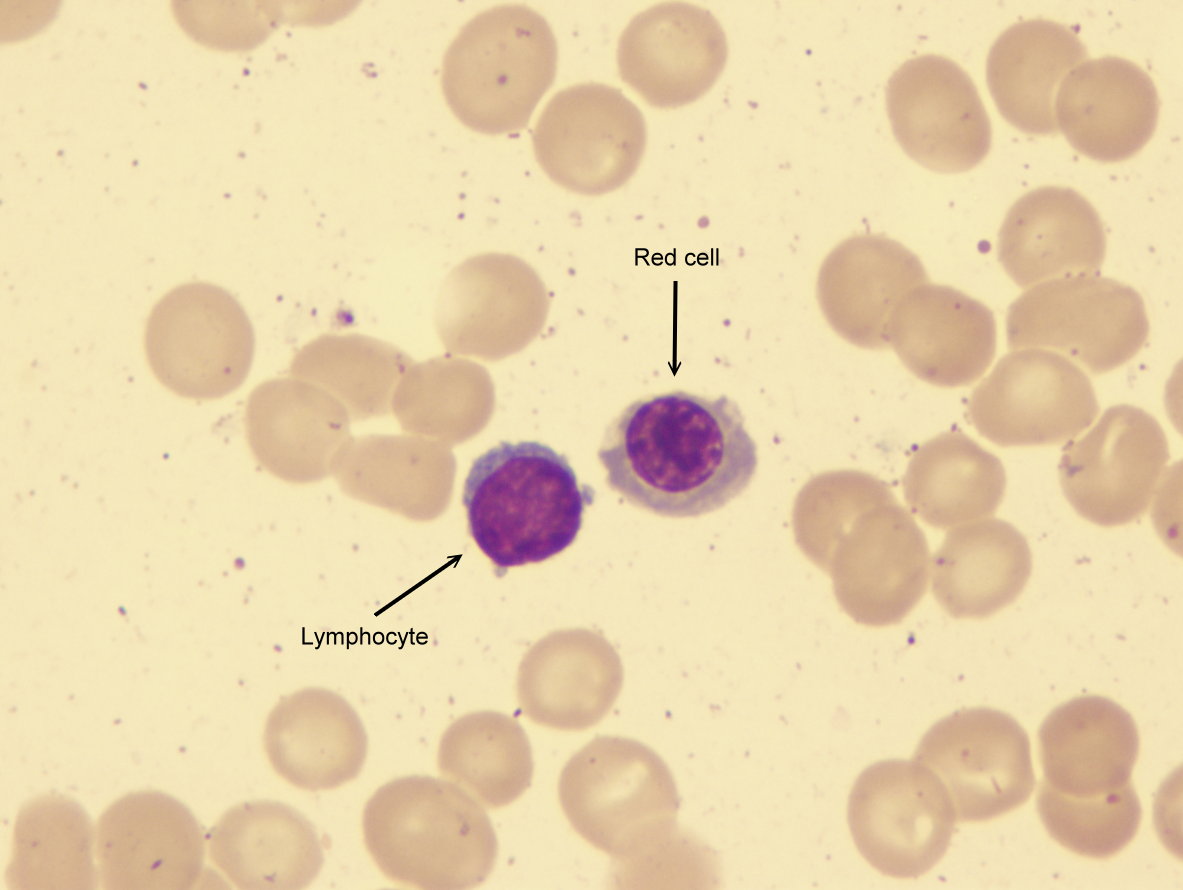 lymphocyte