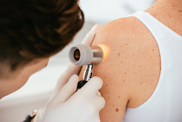 Melanoma Treatment Market