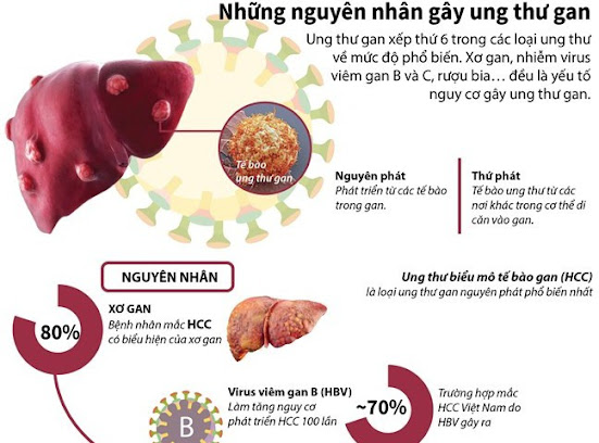 Nguyên nhân dẫn đến ung thư gan mọi người nên biết