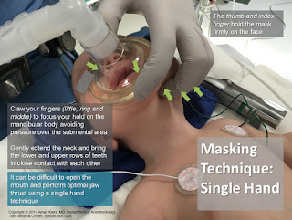 Masking Techniques in Pediatrics