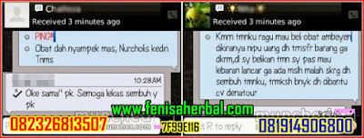 Testimoni Cara Mengobati Ambeien Setelah Operasi