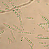 Fusarium dan Phytophthora Cendawan Penyebab Penyakit Penting Di Dunia