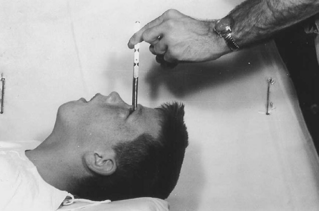 weird medical facts, lobotomy