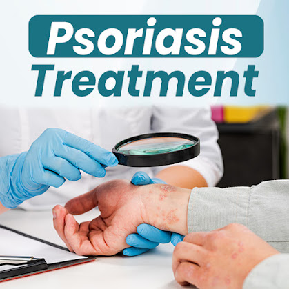 homeopathic treatment for plaque psoriasis
