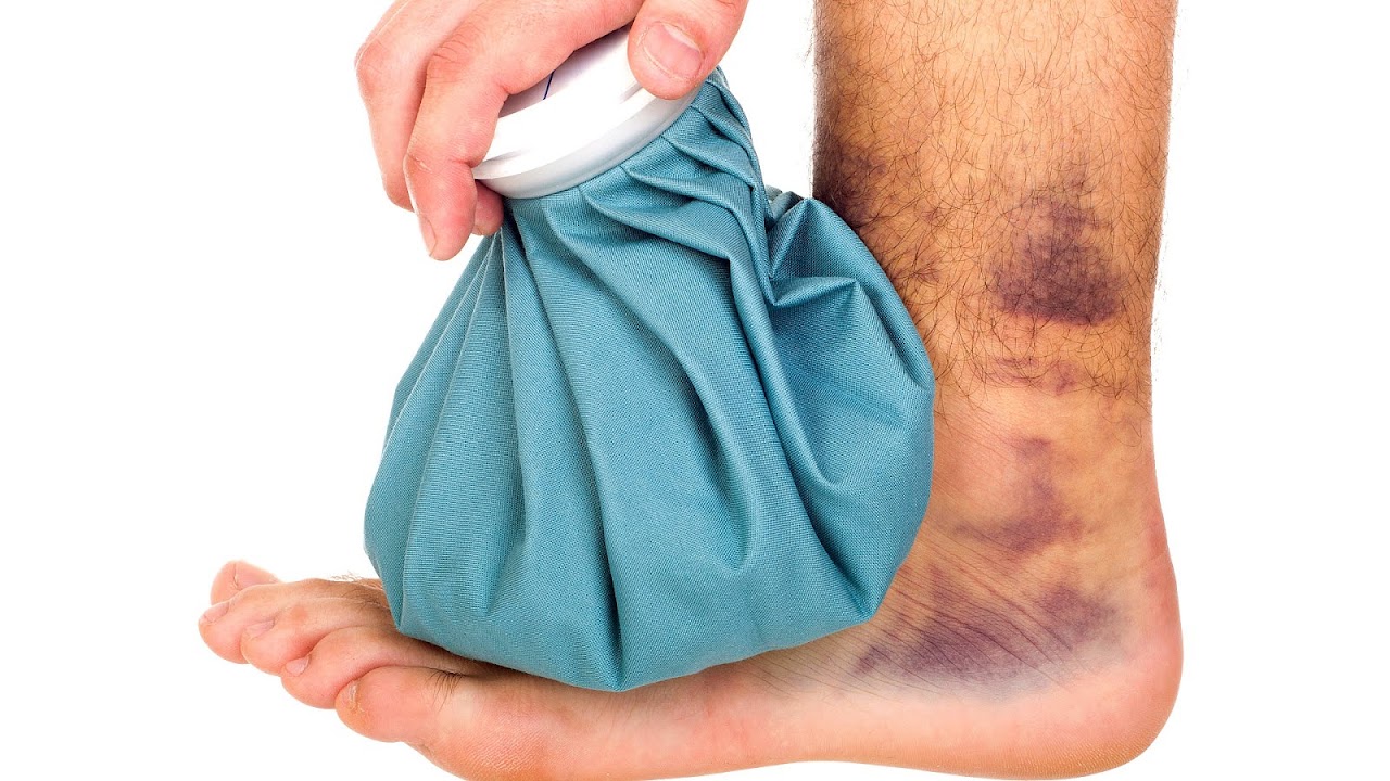 Cold compression therapy Injury