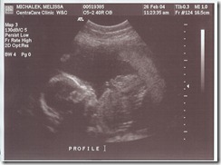 0 US Stanley 20 wks