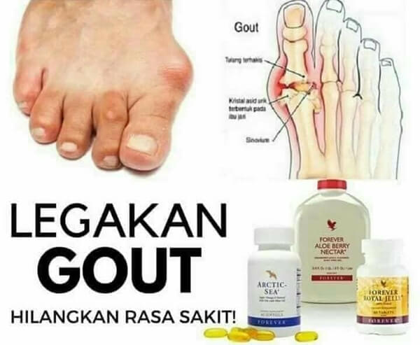 tanda asid urik dalam badan