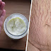 This Homemade Lotion Removes Stretch Marks Magically In just 2 Days