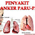 Rokok Ubah Sel Paru-paru menjadi Kanker