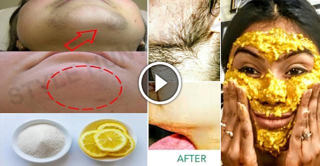 DIY - How To Remove Facial Hair Within 1 Hour