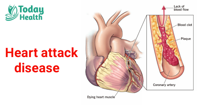 Heart attack disease in hindi