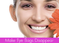 Bag Under Eyes3