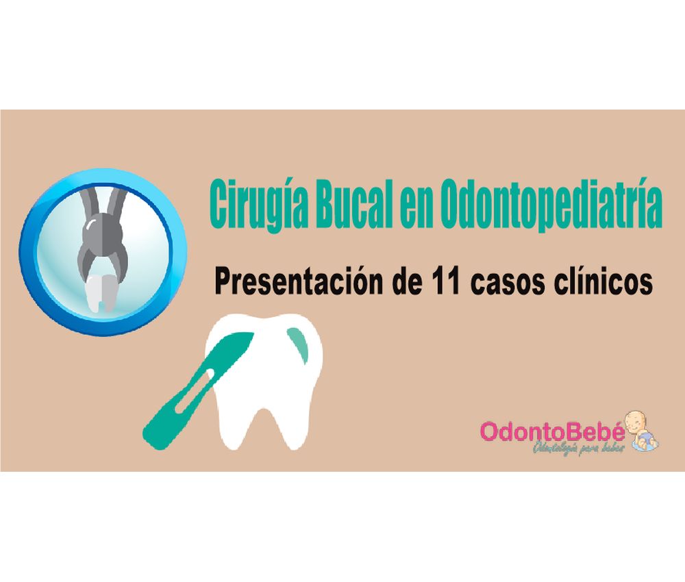 Cirugía Bucal en Odontopediatría