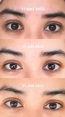 beauty-of-joseon-revive-eye-serum-before-after-bintangmahayana-com