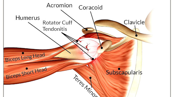 What Are The Symptoms Of A Rotator Cuff Injury