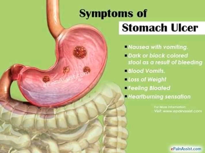 Complications of stomach Ulcer Foods To Avoid - Grace Ngo Foundation