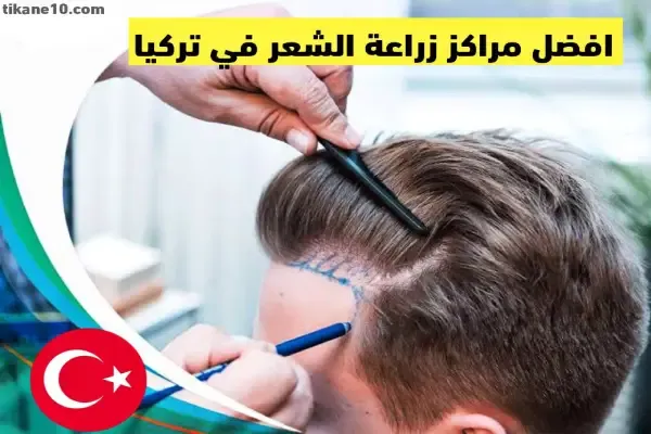 أفضل مركز لزراعة الشعر في تركيا