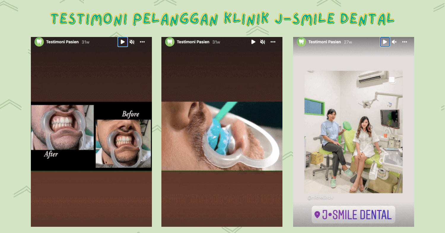 klinik gigi di senayan