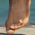 El jugador de NBA con el pies más feo del mundo?