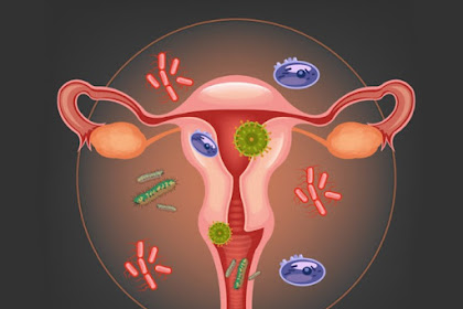  6 Best Home Treatments for Bacterial Vaginosis