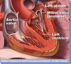 mitral-valve