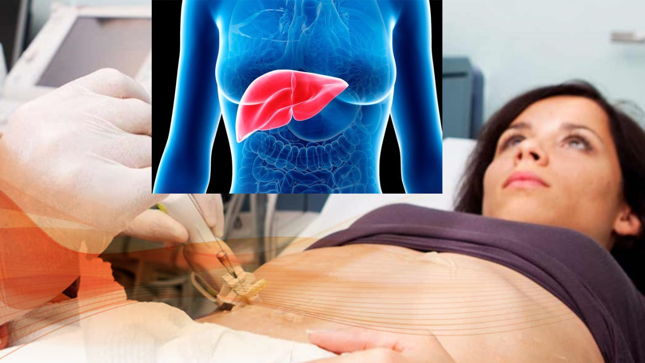 Recognize the Symptoms of Liver Disease that You Shouldn't Ignore