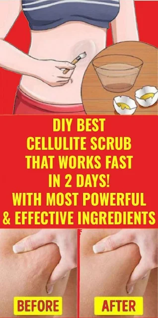 Strongest Killer For Cellulite Mix The Two Ingredients And Apply On The Thighs And Buttocks (Recipe)