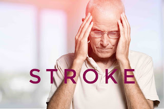 Best Treatment for Stroke