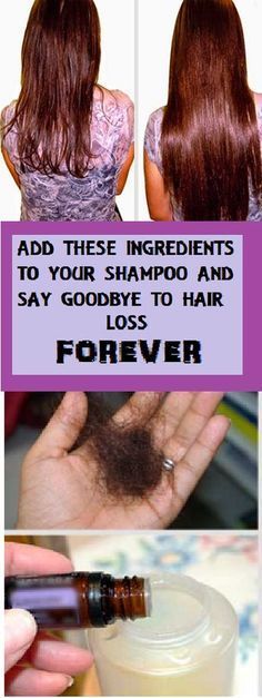 Just Add These Two Ingredients To Your Shampoo And Say Goodbye To Hair Loss Forever