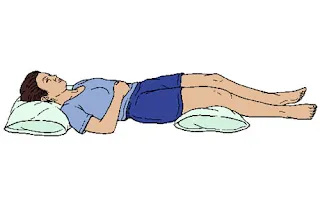 Лечебна поза за сън с възглавница под коленете