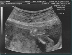 ultrasound_0008