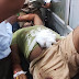 सुलतानपुर में बदमाशों की गोली से घायल युवक लखनऊ रेफर,पुलिस अधीक्षक ने घटनास्थल का किया निरीक्षण