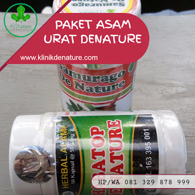 CARA MENYEMBUHKAN ASAM URAT