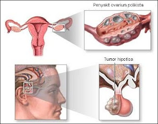 Connectionebscohostcompregnancy After Chemotherapy Induced