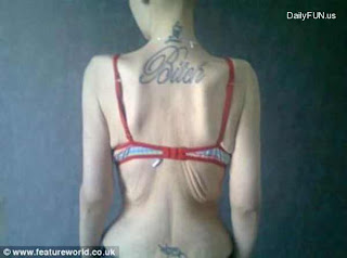 going from fat to anorexic 9 ΣΟΚ! Από παχύσαρκη έγινε ανορεξική... (pics)