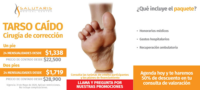 Precio Paquete Cirugia Tarso Caido Correccion Paquete Guadalajara Mexico