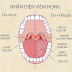 Mổ dây thanh bằng phương pháp nào hiệu quả