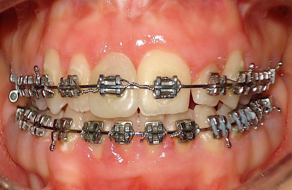 Orthodontics