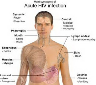 symptoms of hiv infection