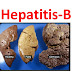 Cara Mengobati Hepatitis B Dengan Resep Obat Tradisional