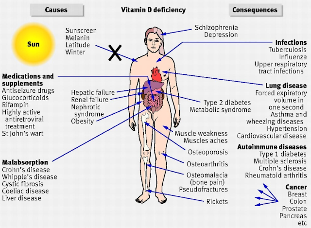 Benefits & Uses of Vitamin D Injections