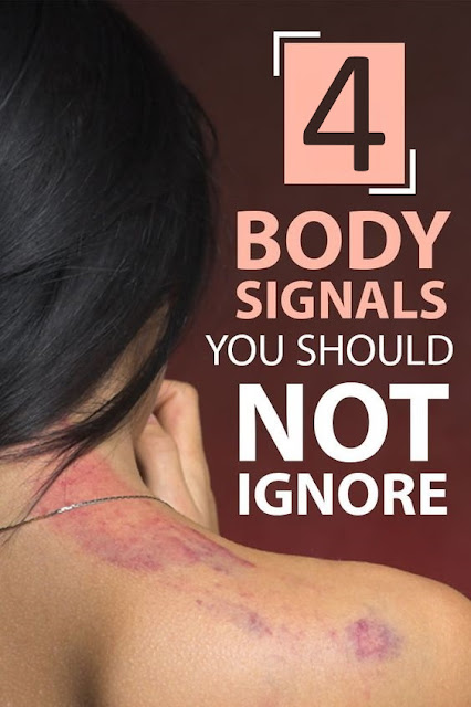 4 Body Signals It’s Better Not to Be Ignored By Those Who Want to Stay Healthy