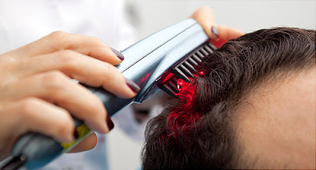 Hair transplant in Jaipur