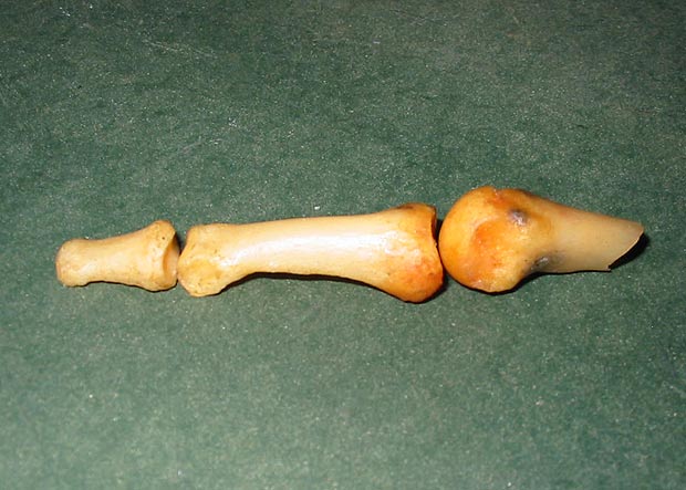 Dave's bone