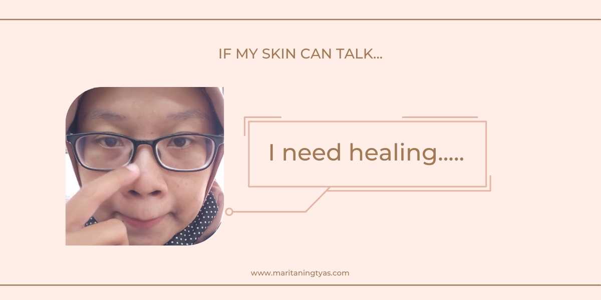 cara melakukan skin healing