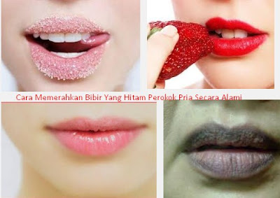 Cara Memerahkan Bibir Yang Hitam Perokok Pria Secara Alami Dengan Cepat Dan Permanen