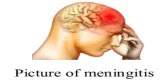 Meningitis