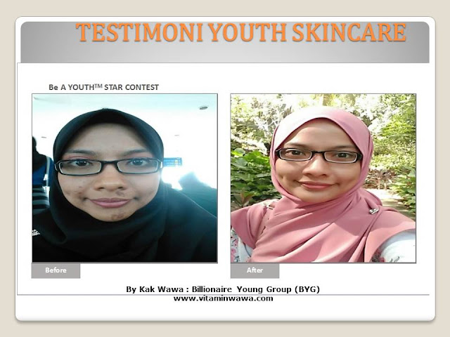 34 Testimoni Youth Skincare Shaklee Terbaru, Youth skincare shaklee, testimoni youth skincare shaklee, Youth Skincare Shaklee : Harga dan Review Pengguna Youth Shaklee, testimoni youth skincare shaklee, testimoni youth skincare shaklee