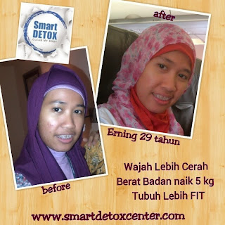 www.SmartDetoxCenter.com