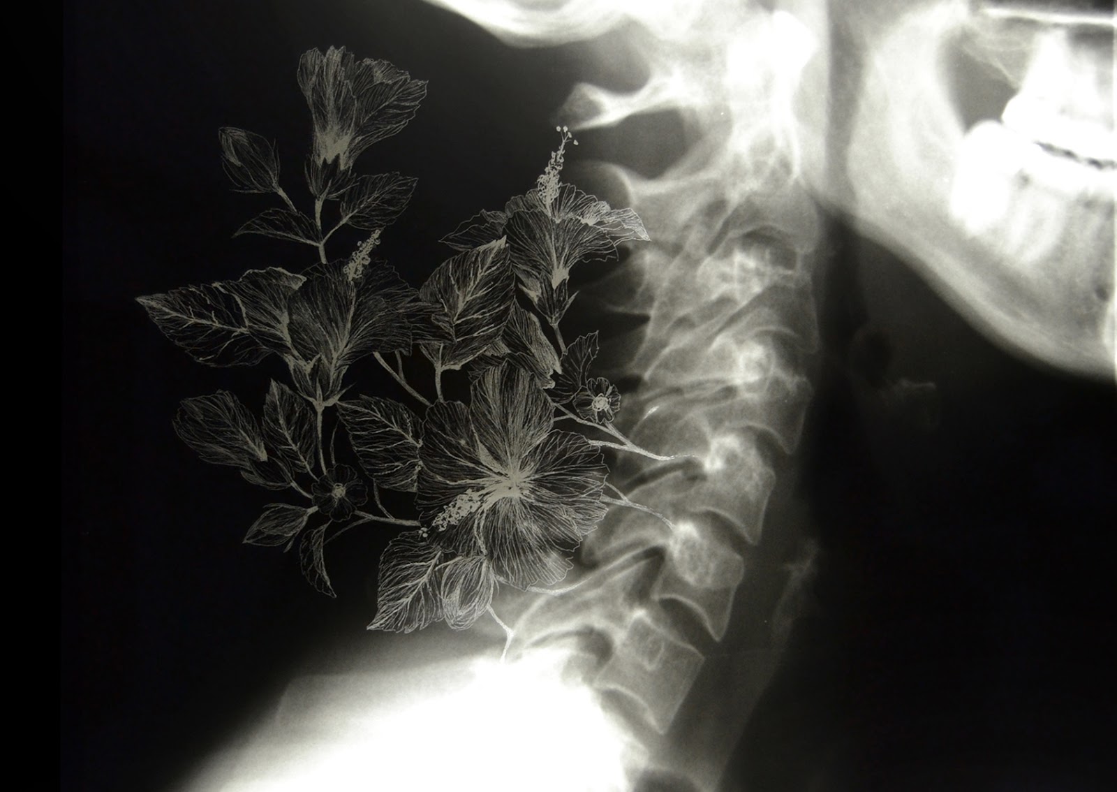 Nunzio Paci, Wild Vertebrae, Manually altered x-ray on LED lightbox